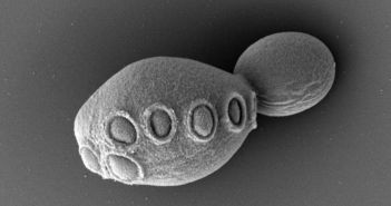 Meilenstein erreicht: Halbsynthetische Hefe mit künstlichem Erbgut (Foto: Cell/ Zhao et al.)